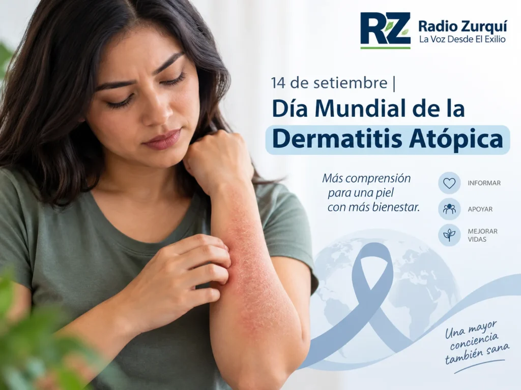 Día Mundial de la Dermatitis Atópica, conmemoración del 14 de setiembre.